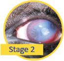 Picture of pink eye stage 2